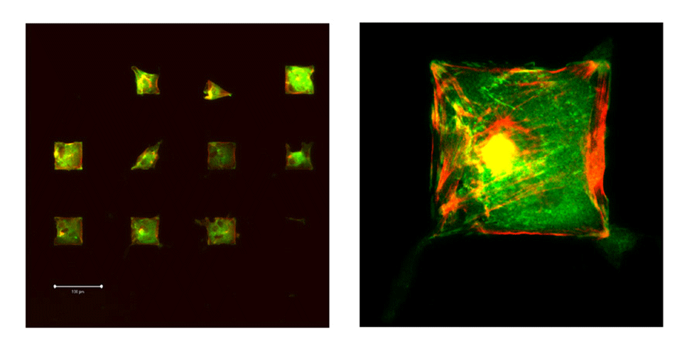Enlarged view: Figure 3: fibroblasts constrained on RGD patterns in a protein resistant background. Patterns: squares of 60x60 mm2.